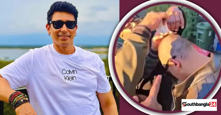 শুটিংয়ে জায়েদ খানের শরীরে ভাঙল পাঁচ টিউবলাইট, মাথায় ঢুকল কাচ